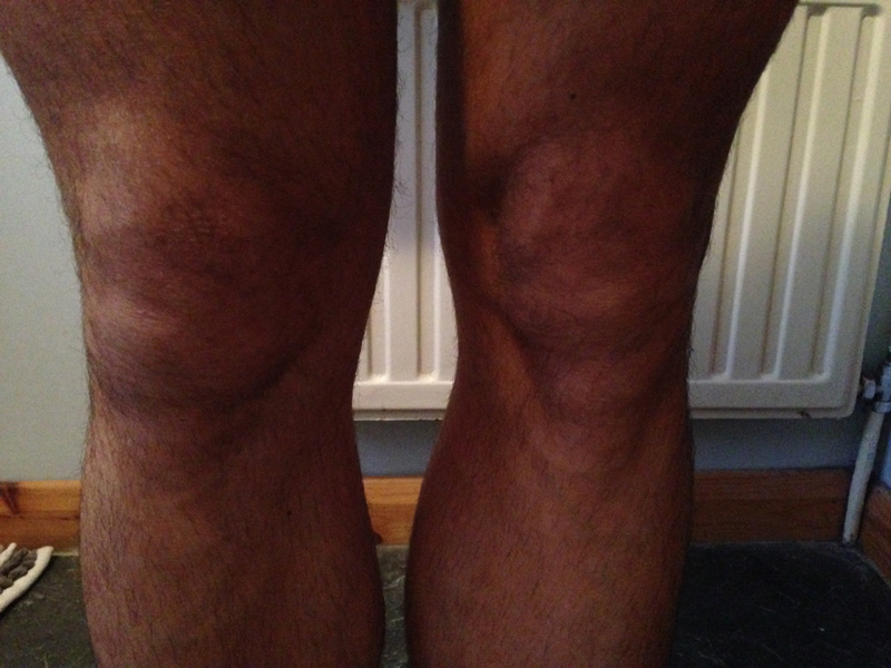 Paul Ali Injured Knee